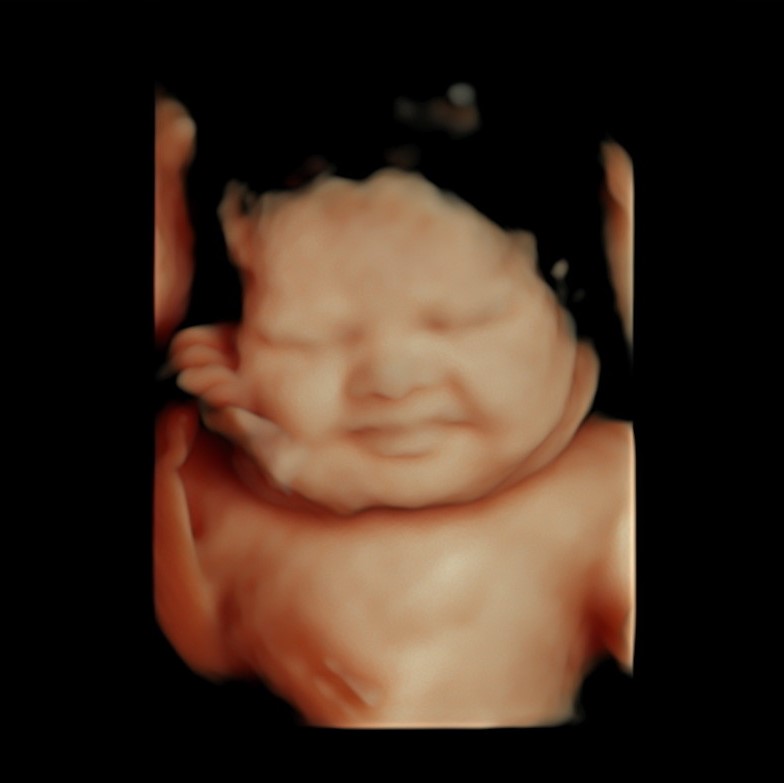 When Is The Best Time To Get A 3D 4D Ultrasound The Ultrasound 