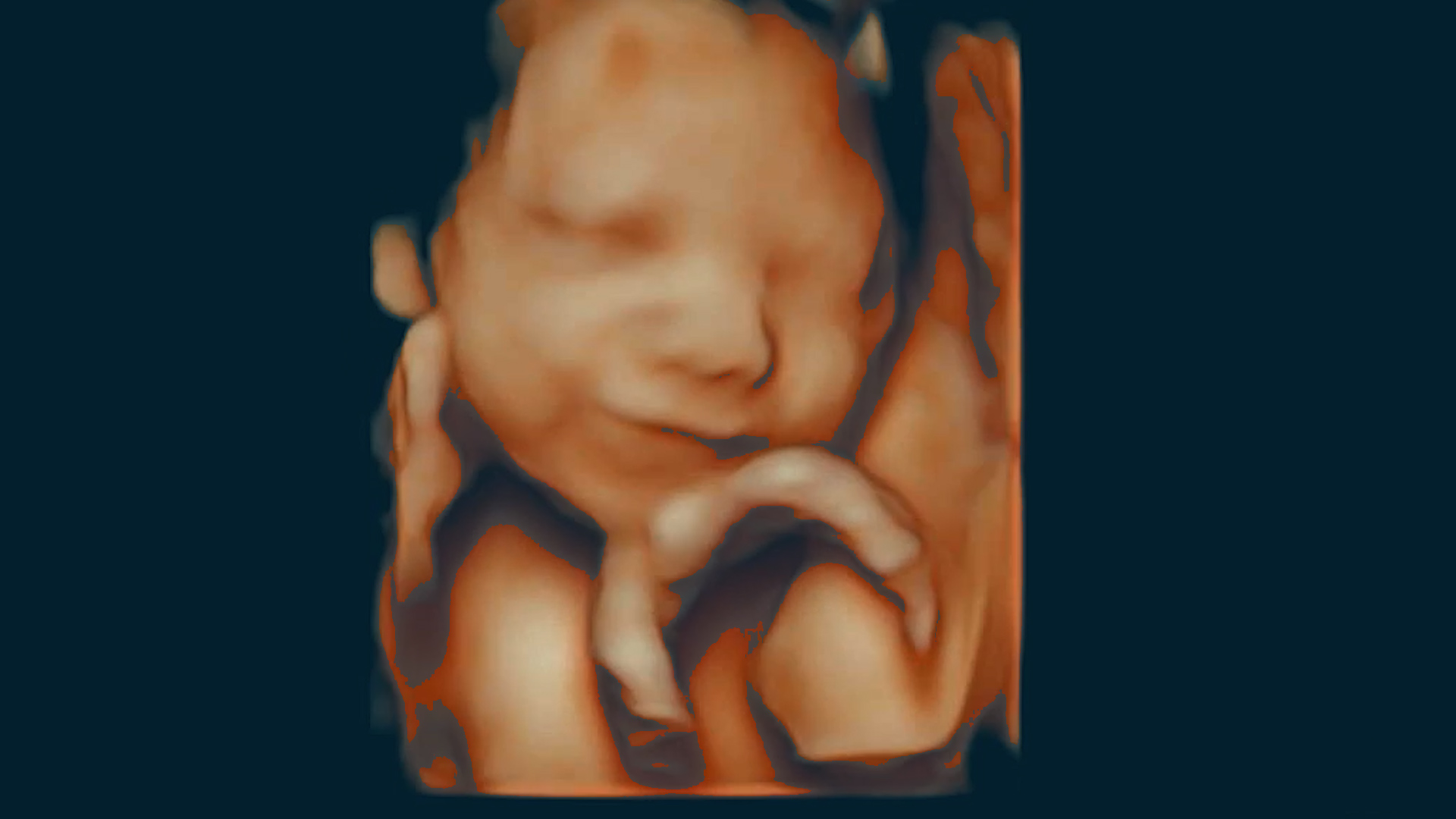 3d baby porn gift 3D Pregnancy Scans in Dublin, Bray, and Gorey
